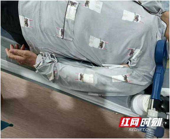 57岁阿姨亲身经历 经颅磁刺激治疗真的有奇效