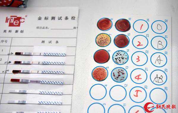 一袋血的“重生”：两个手臂之间的旅程