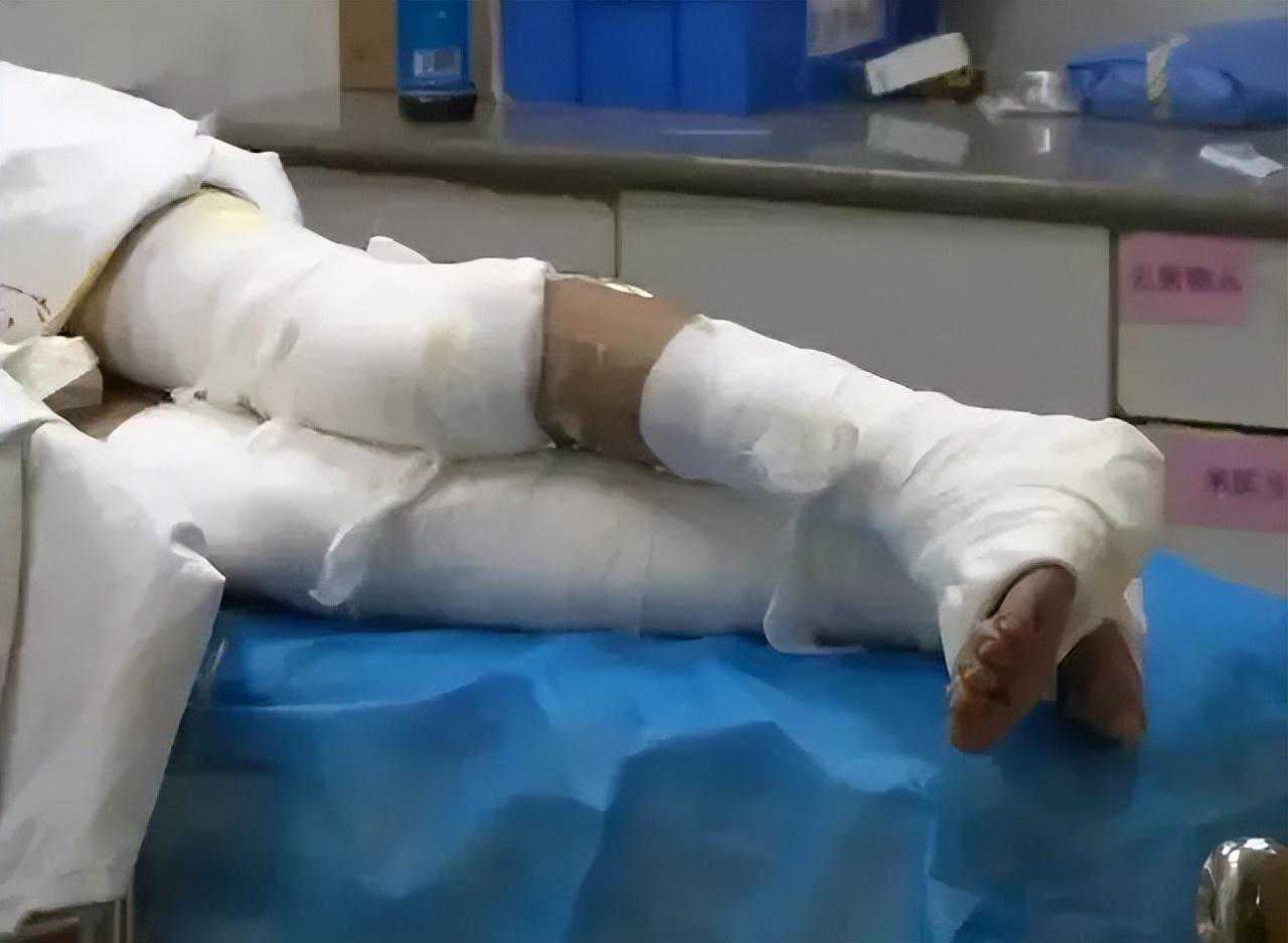 小粉尘，大隐患！教你认识什么是粉尘爆炸